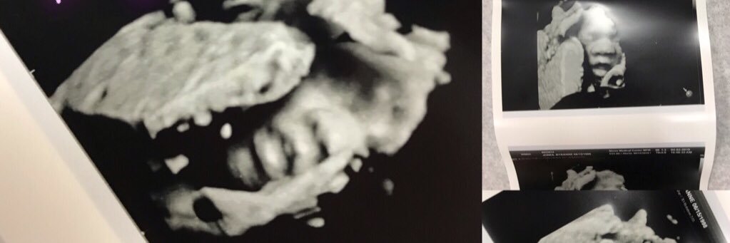 __AllME's profile banner image