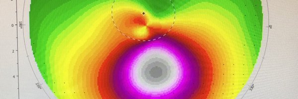 keratoconusdoc Profile Banner