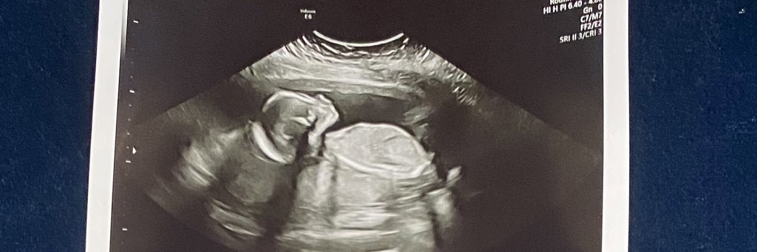 Katelynn1521's profile banner image
