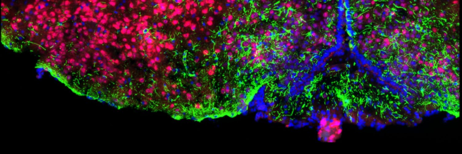 Samuel Bennett banner