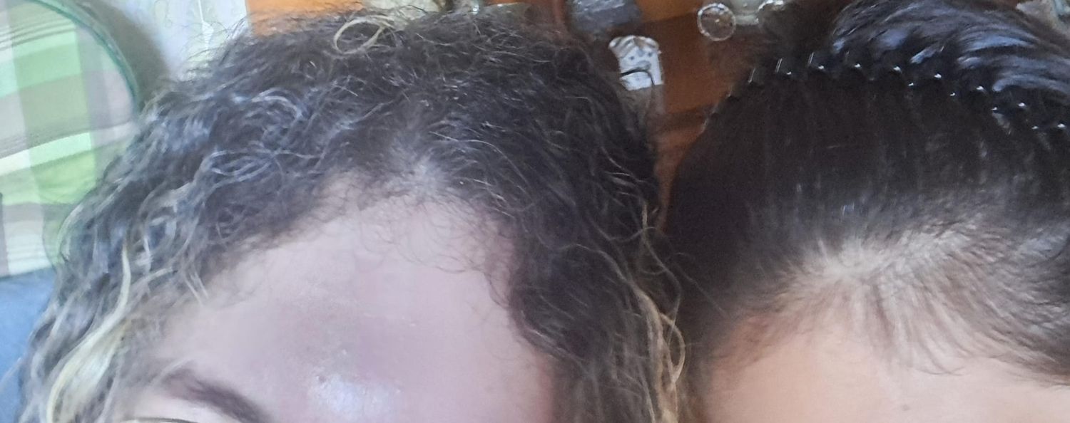 Denise 🪸🔥 banner