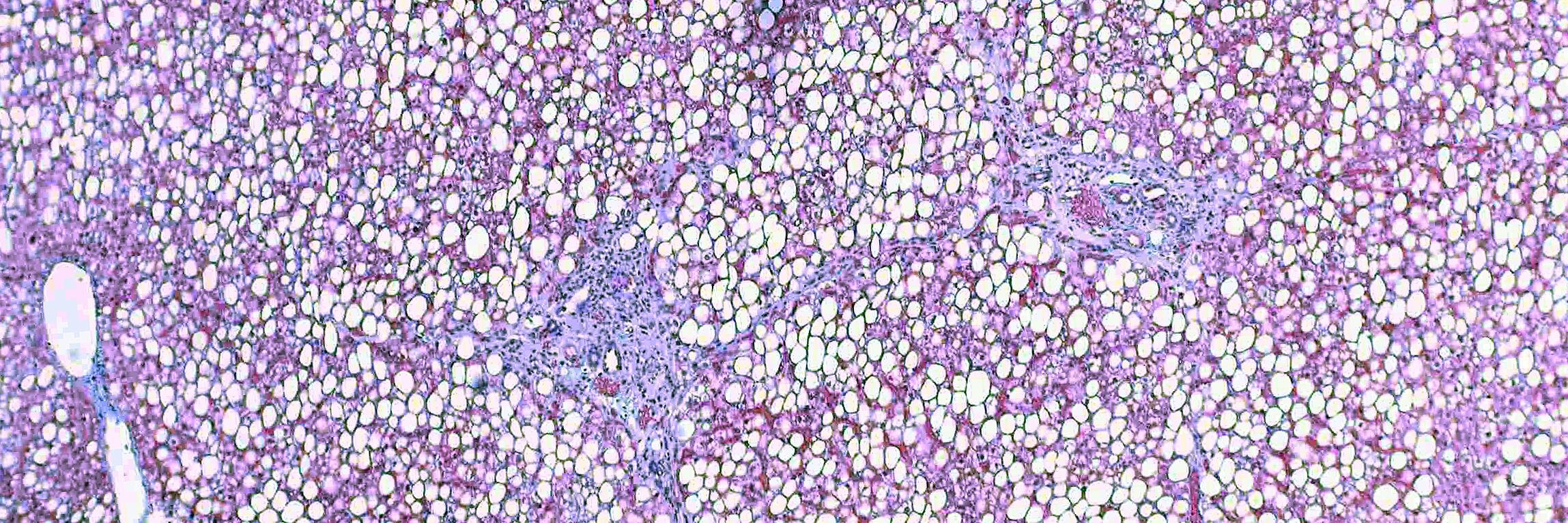 Jeff Schwimmer banner