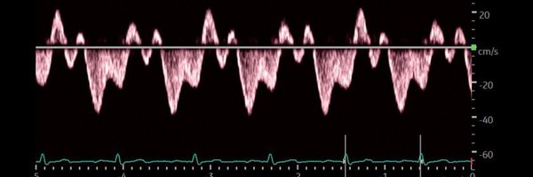 NephroPOCUS Profile Banner