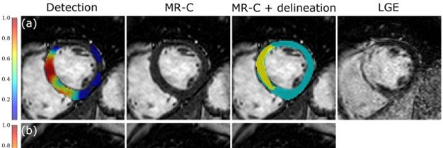 Matías Calandrelli banner