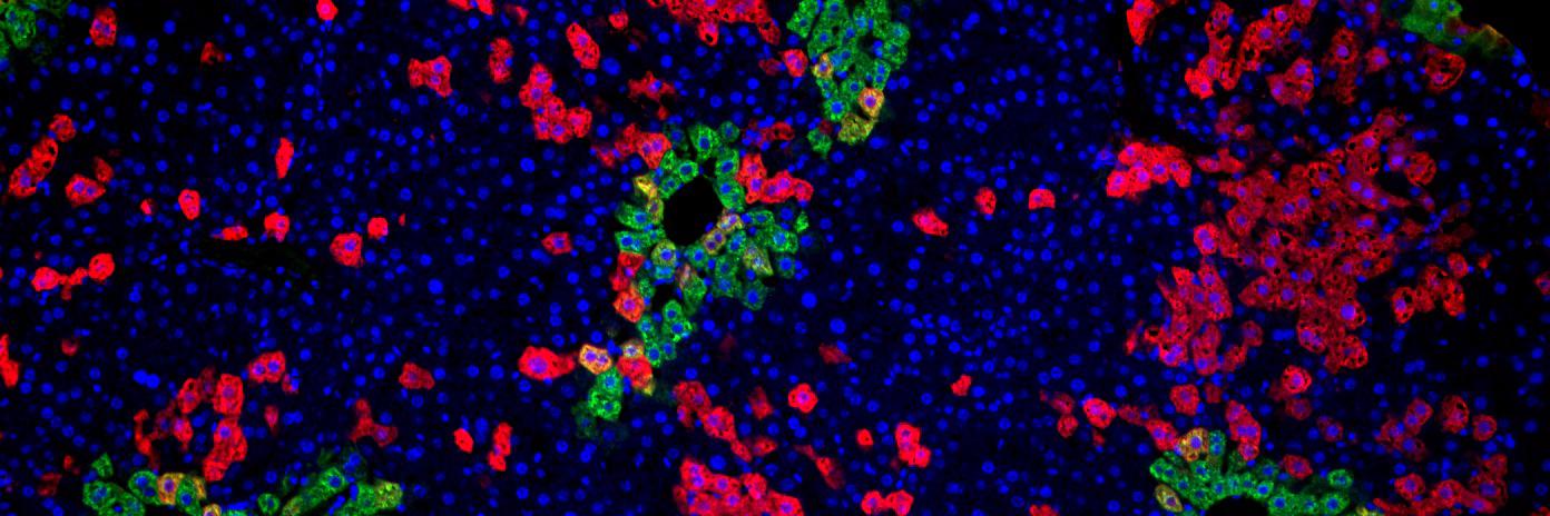 Steven Artandi, MD, PhD banner