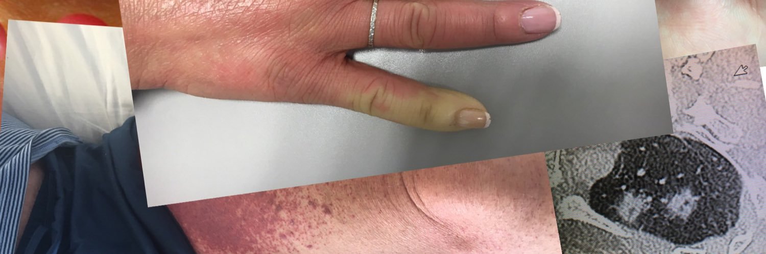 @UMASMutuaTerrassa banner