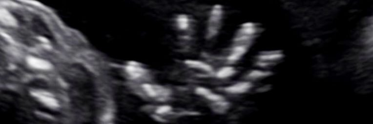 CyrilZuber's profile banner image
