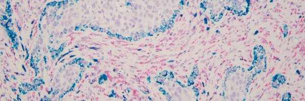 LobergMatthew Profile Banner