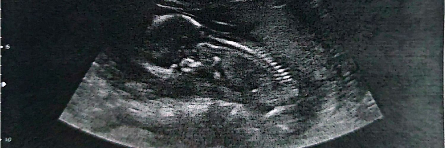 HugoSandrini21's profile banner image