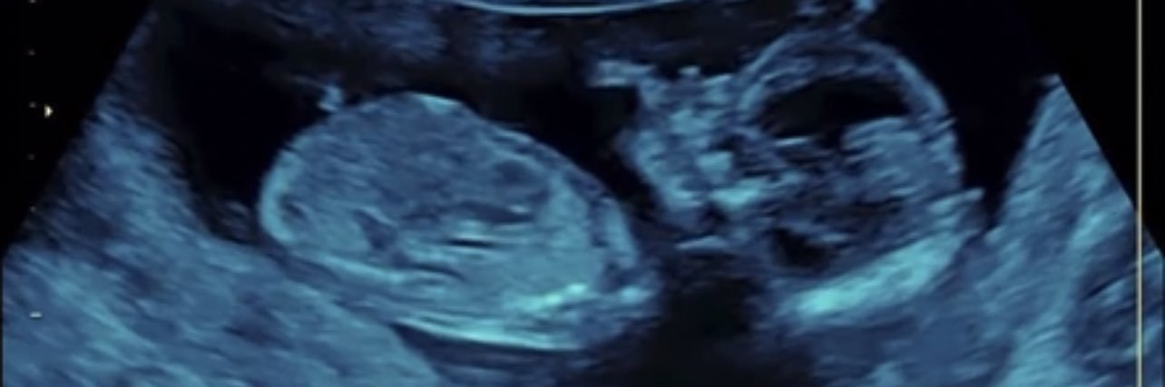 JeffPedigo24's profile banner image