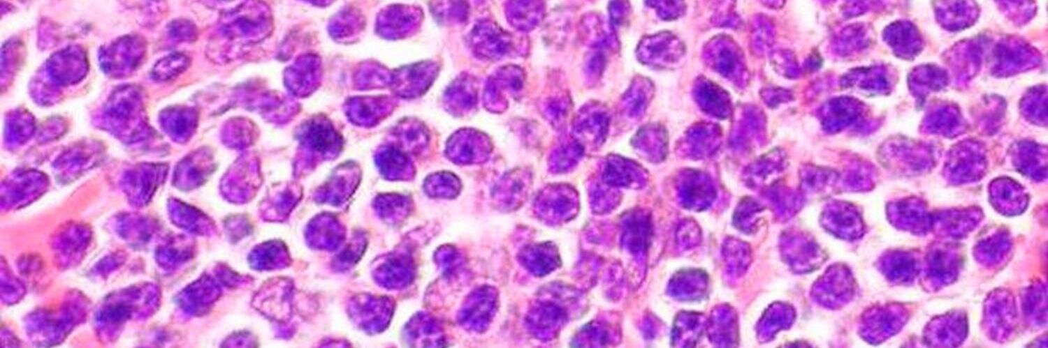SurgicalPath's profile banner image