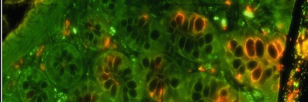 GFPvirus Profile Banner