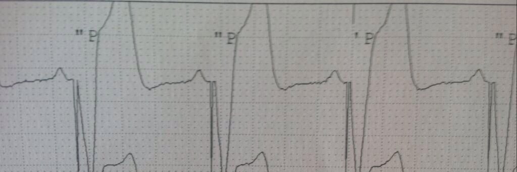 KeepTheBeatAlive banner