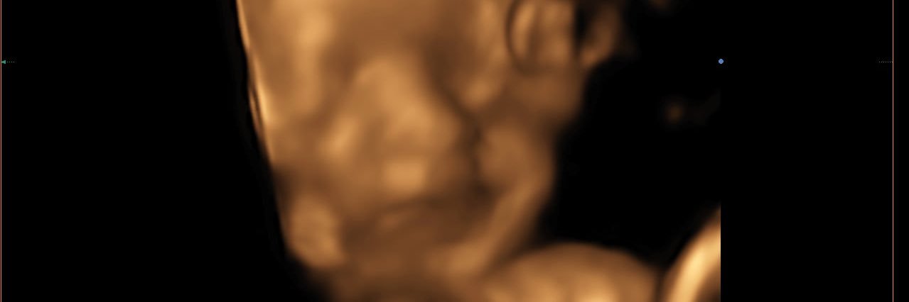 𝓗𝓪𝔃𝓮𝓵 banner