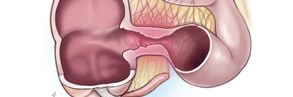 IBD_FloMD Profile Banner