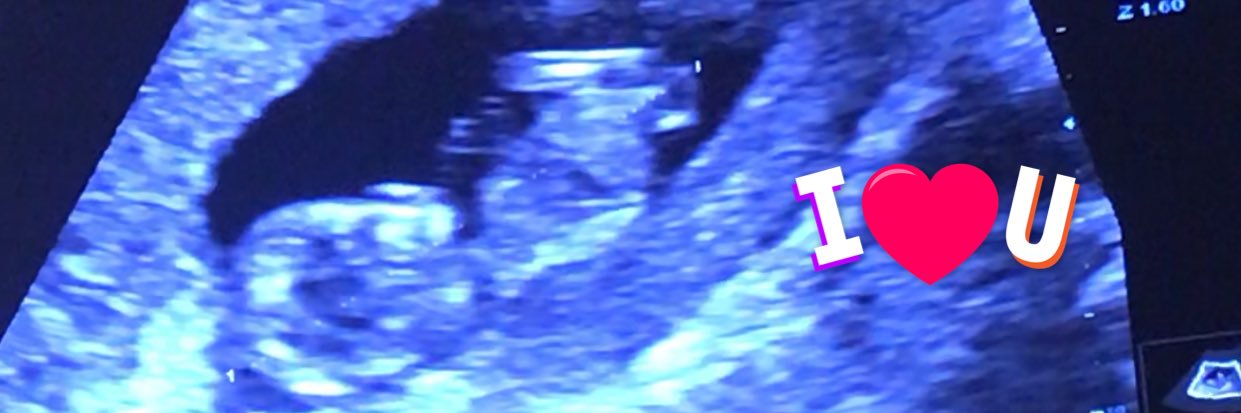 keem0ney's profile banner image