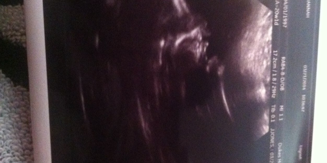 hannah_fishback's profile banner image