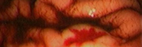 JakobFor Profile Banner
