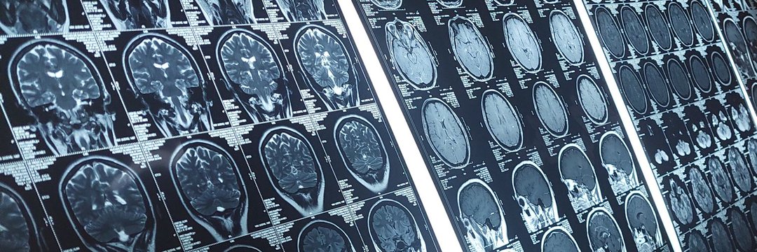 neuroavance's profile banner image