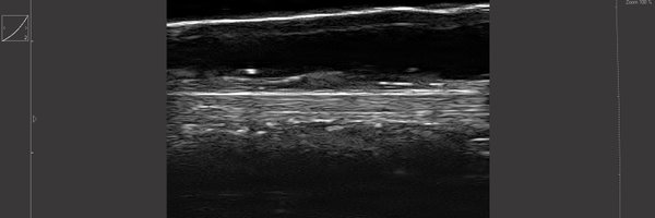 BiomechHullfish Profile Banner