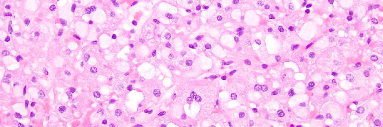 GU Pathology Society (GUPS)'s banner