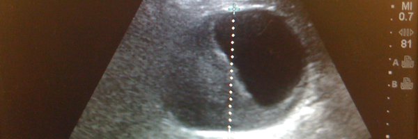 PocusEast Profile Banner