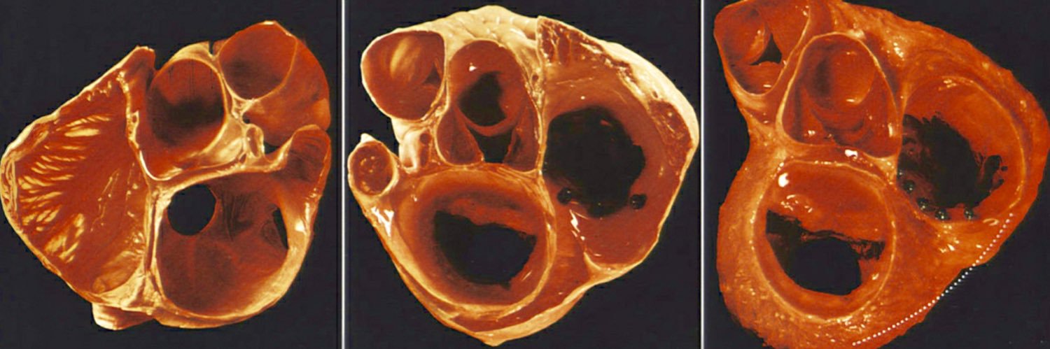 Brock Gambill banner