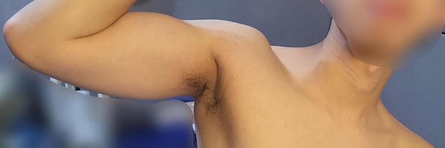 E banner