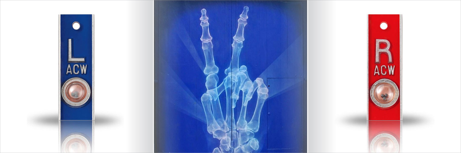 Magic X-ray Markers (@magicesip) / Posts / X