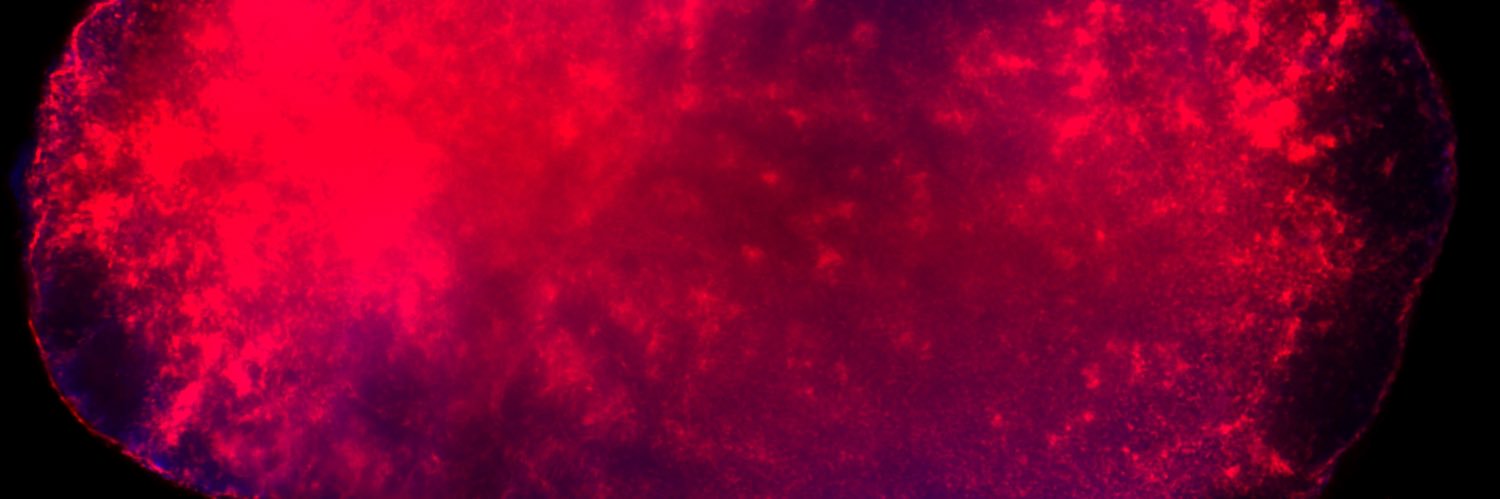 Benjamin Broomfield banner