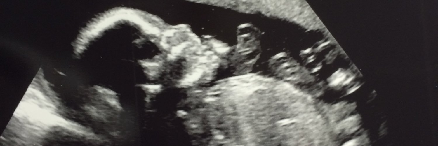 kadieadele's profile banner image