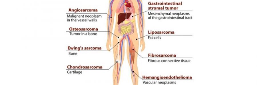 Lady Sarcoma 🎗🌻 banner