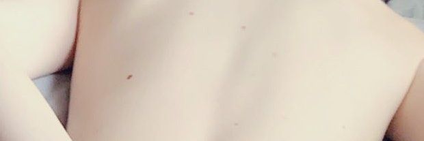 ปิดบอท banner