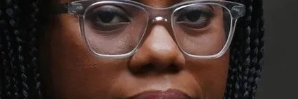 Bits_Missing 🌍🇺🇦 🇪🇺 🇵🇸💙 #FBPA #FBPR banner