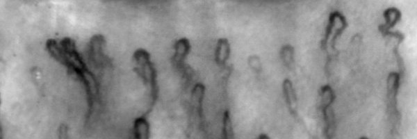 SclerodermaM Profile Banner