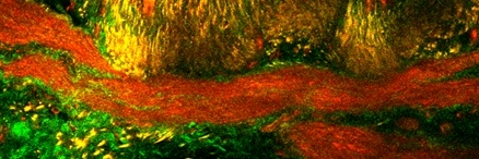 Hari Parameswaran's lab at NU banner