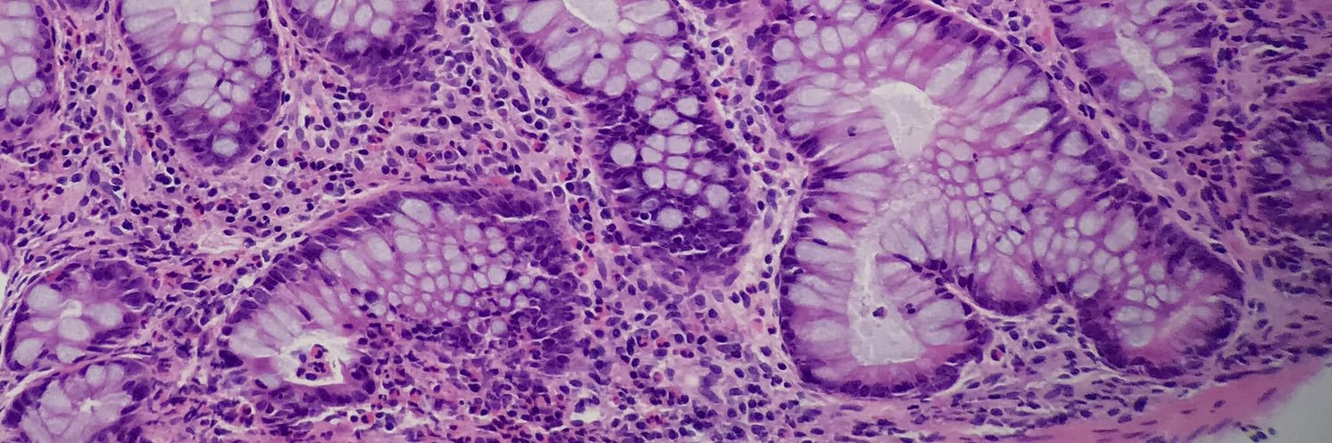 EccoIbd's profile banner image