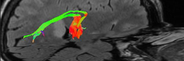 MSKNeurosurgery Profile Banner