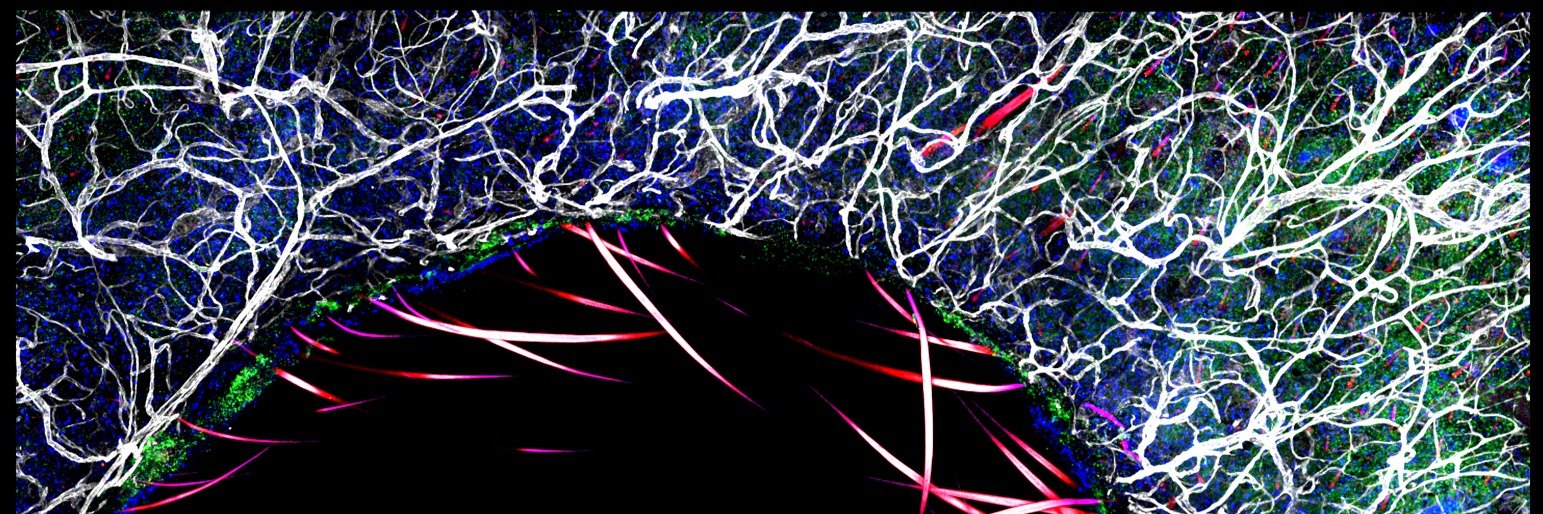 Ollie Harrison banner