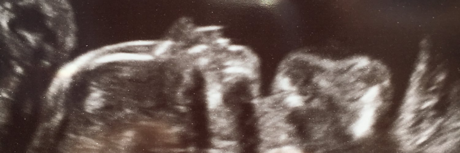 AlaynaMiller145's profile banner image