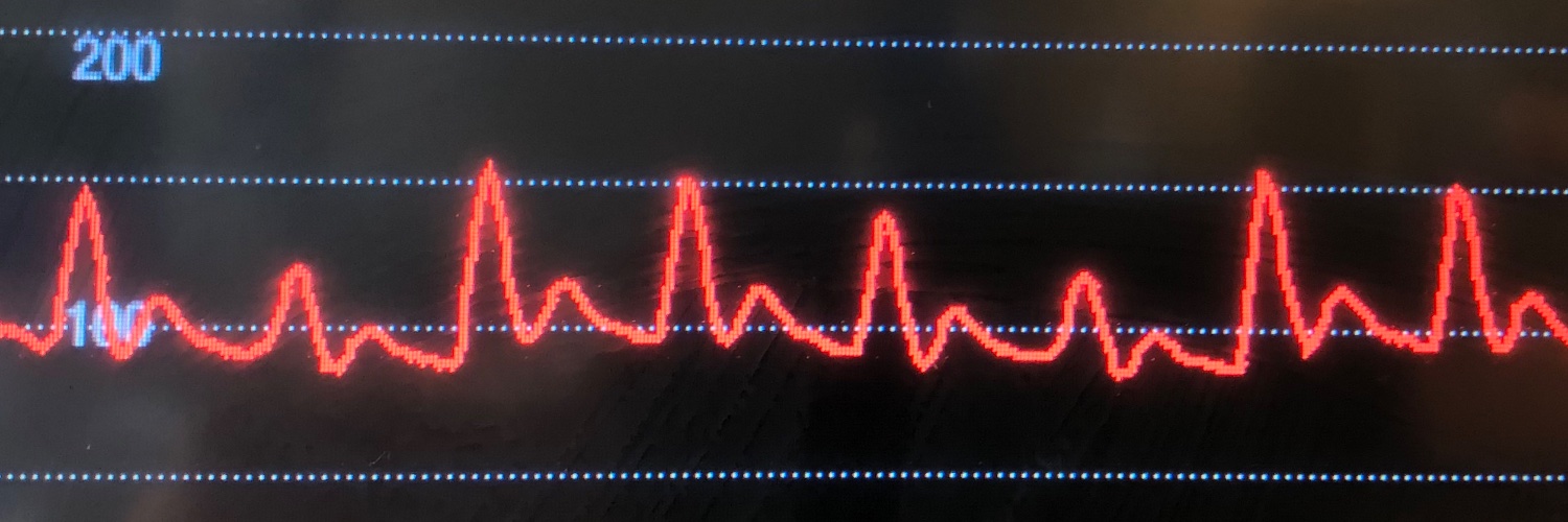 Richard Cashmore banner