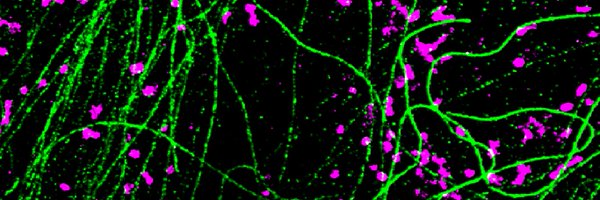 NitinRammohan Profile Banner