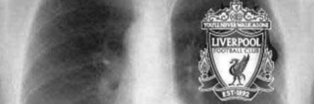 JB banner