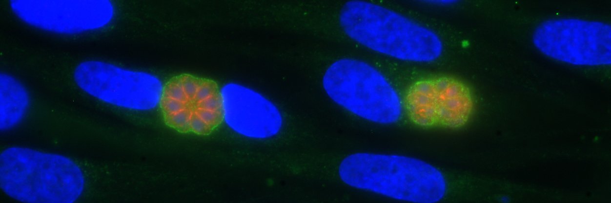 David Arranz Solís 🇪🇸 🇺🇸 banner