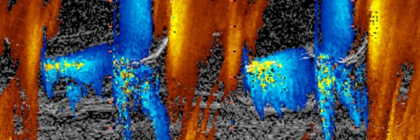 EchofirstB Profile Banner