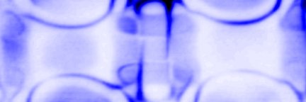 Niels Schröter banner