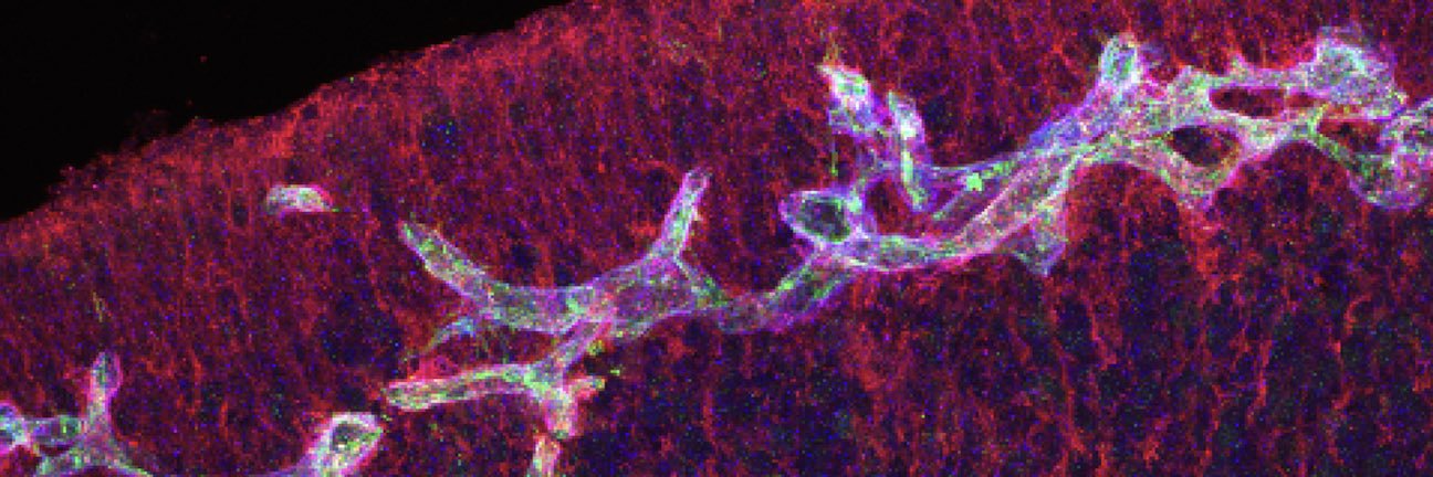 Elizabeth Crouch, MD/PhD's banner