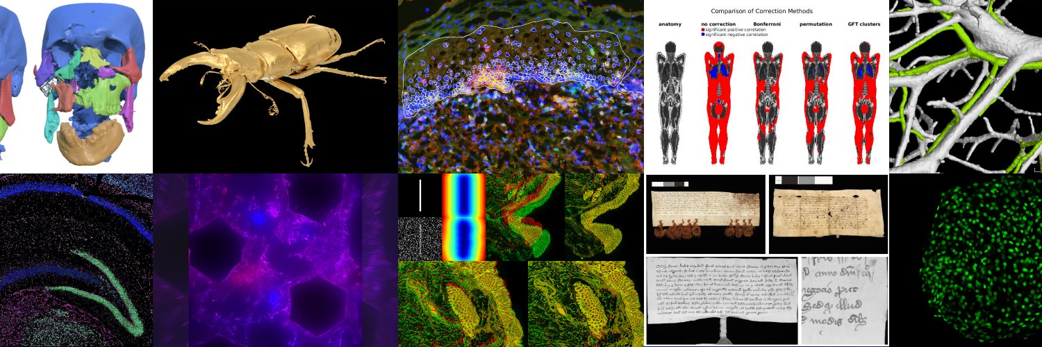 Centre for Image Analysis banner