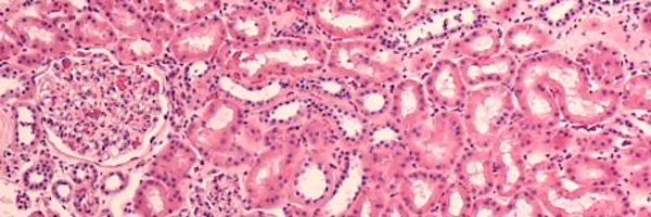 scotrenalbiopsy Profile Banner