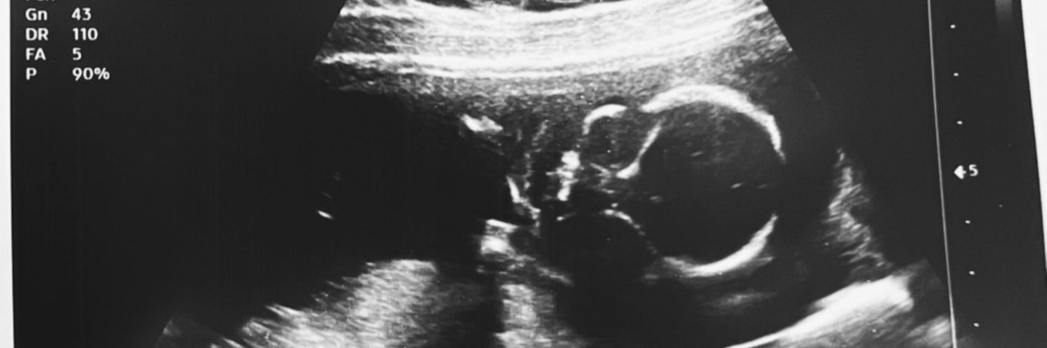 a_mejiaa's profile banner image